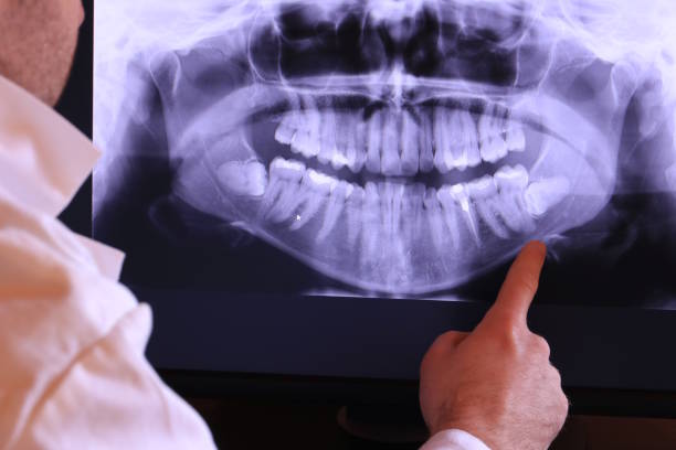 Best Urgent Care for Lost Fillings or Crowns in Lihue, HI