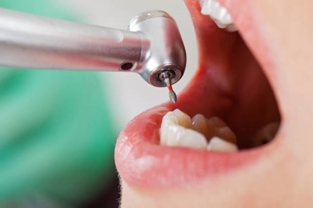 Best Emergency Treatment for Dental Infections or Abscesses in Lihue, HI